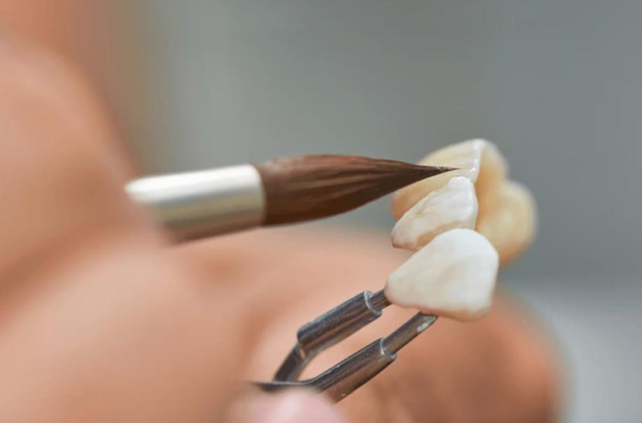 Brush painting ceramic dental crowns details