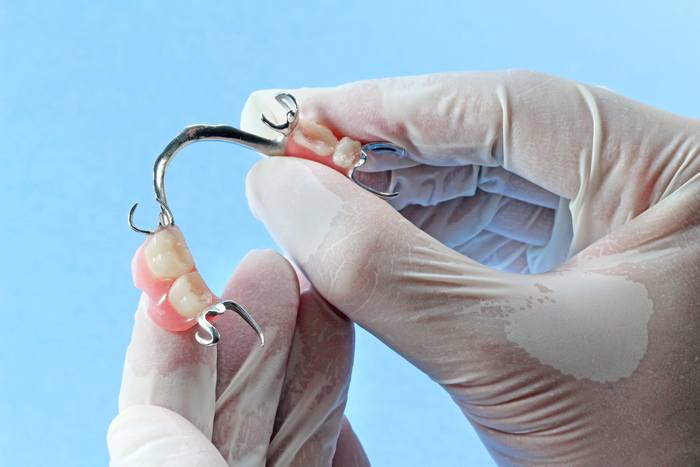 Dentures held by gloved hands against blue background